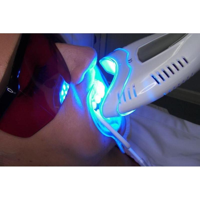 Teeth whitening laser and products